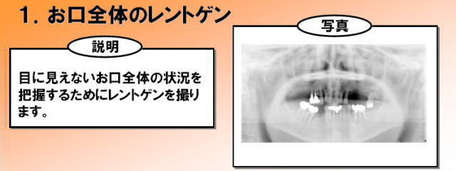 お口全体のレントゲン